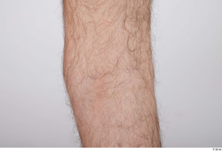 Dio hairy knee nude 0006.jpg